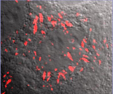 rhodamine fibronectin